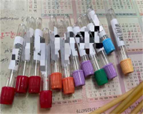 俄罗斯做试管婴儿翻译 俄罗斯做试管婴儿攻略