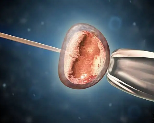 哪里有供卵医院_供卵经历,阳泉供卵试管婴儿个人空间