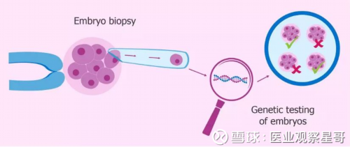 代怀网费用问题,子宫后位性不孕可用试管婴儿助孕