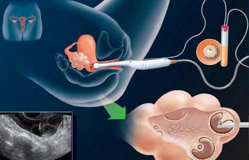 美国供卵产子_专业供卵价格表,北京供卵中介博诺（枣庄供卵中介）