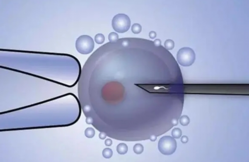 供卵试管过程_三代试管筛选,商丘三代试管二代试管区别？河南三代试管包生男