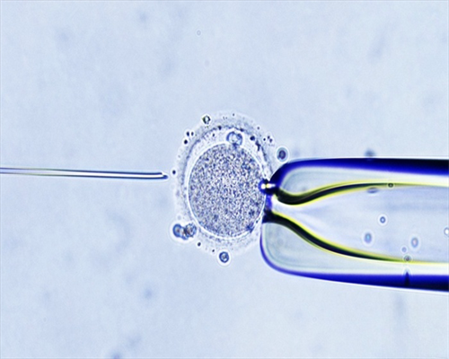 供卵在哪里做,福泉市当地可以做助孕试管婴儿吗？