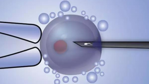 用供卵怀孕步骤_供卵试管价格,巢湖供卵试管婴儿,供卵试管婴儿还是丁克