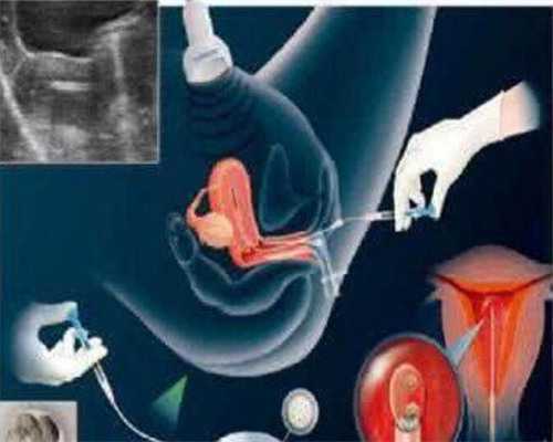 广州金贝供卵医院怎么样_金贝供卵生殖中心电话|苏州供卵第三代试管婴儿医院