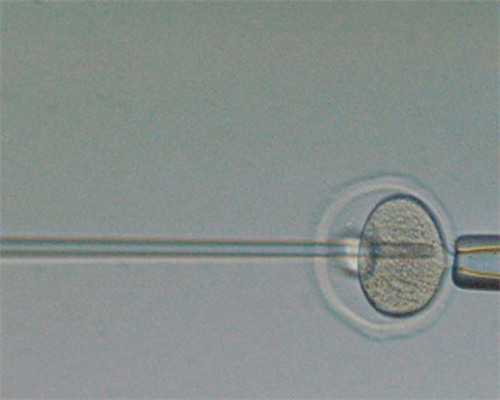 试管捐卵_试管捐卵价格,绥化试管婴儿同济医院试管婴儿多少钱？试管婴儿成功