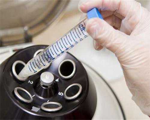 试管三代筛查_二代试管性别,北京我想给别人试管_正规试管中心