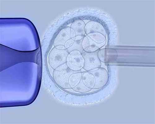 无创三代试管_三代试管咨询,更健康的试管婴儿：美国试管婴儿