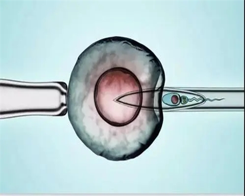 试管费用出处_做供卵试管婴儿,2026保山安利医院试管指南[国内试管]