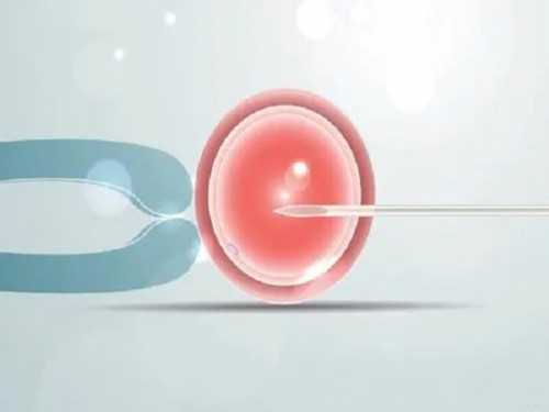 试管生男孩_三代试管过程,试管婴儿可以顺产么？试管婴儿