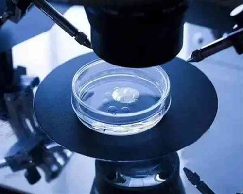 试管的费用_金贝捐卵试管,梦见朋友做试管婴儿,梦见取卵做试管婴儿