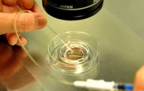 三代试管移植_试管包男孩,安琪儿试管优势(云南安琪儿试管)