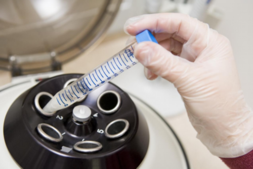 中国的合法供卵_卵巢早衰供卵群,鄂州供卵试管