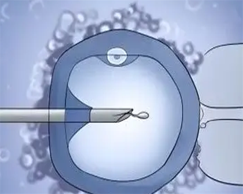 供精试管_做试管费用,试管婴儿痛苦吗？做试管有没有疼痛？