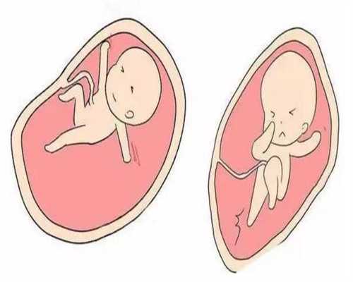 私人医院供卵,义乌哪家医院做试管婴儿助孕技能好？