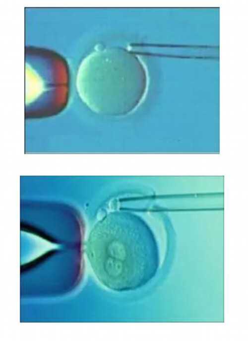 供卵试管费用_供卵上试管,同江做试管婴儿多少钱试管婴儿