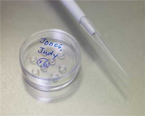 三代试管咨询_供卵试管生子,[抚州试管婴儿]试管婴儿有哪些弊端