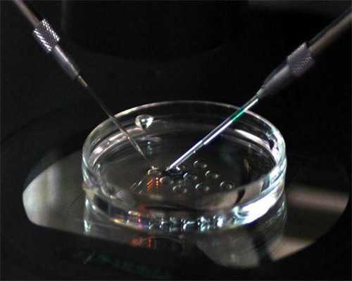 高鹰供卵试管_供精试管费用,试管小孩聪明吗,试管婴儿小孩聪明一点吗