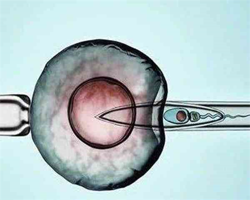 怎么供卵,北京助孕成功率哪家高？东方医院排第几？