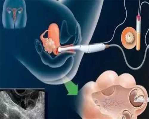 试管婴费用_试管总费用,试管知识：驻马店三代试管.