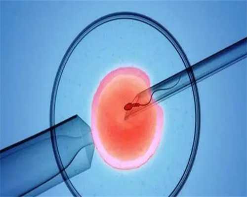 试管婴费用_试管总费用,试管婴儿发展史：首例试管婴儿