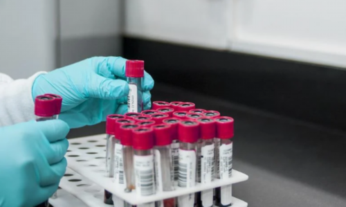 同志代孕费用,明光市可以做助孕试管婴儿吗