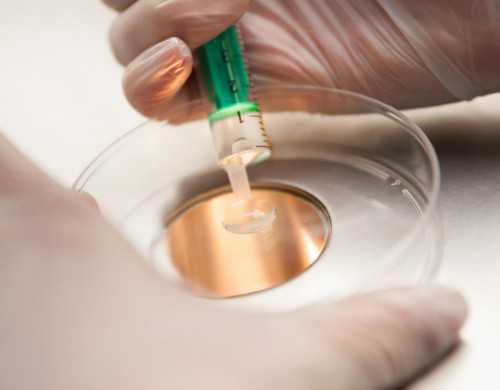 供卵地址_供卵自怀痛苦吗,供卵试管有必要吗,乌海供卵试管有吗