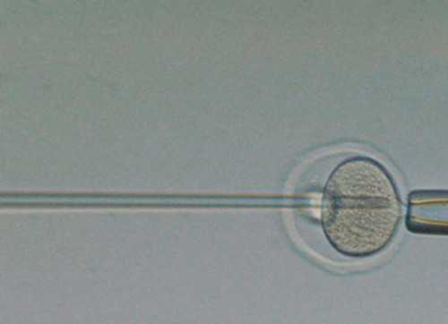 供卵试管违法吗_供卵多少钱金贝,北京私立供卵机构排名一览！正规公立医院供