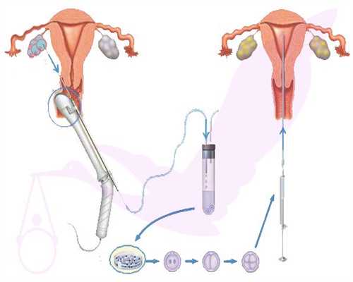 高龄供卵助孕,我来推荐!天津助孕医院交流群?