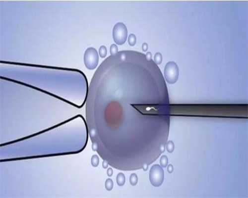 代生一单多少钱,北京三代试管助孕中介